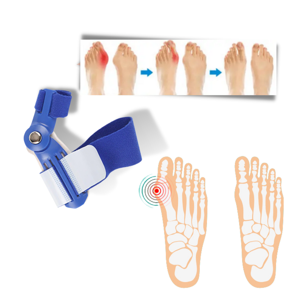 Correcteur orthopédique d'oignon