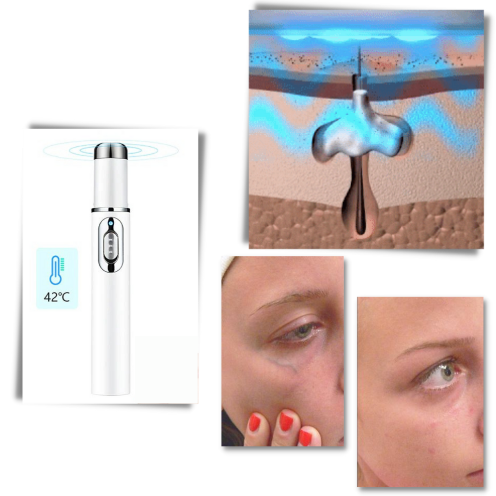 Stylo de thérapie de la peau à la lumière bleue