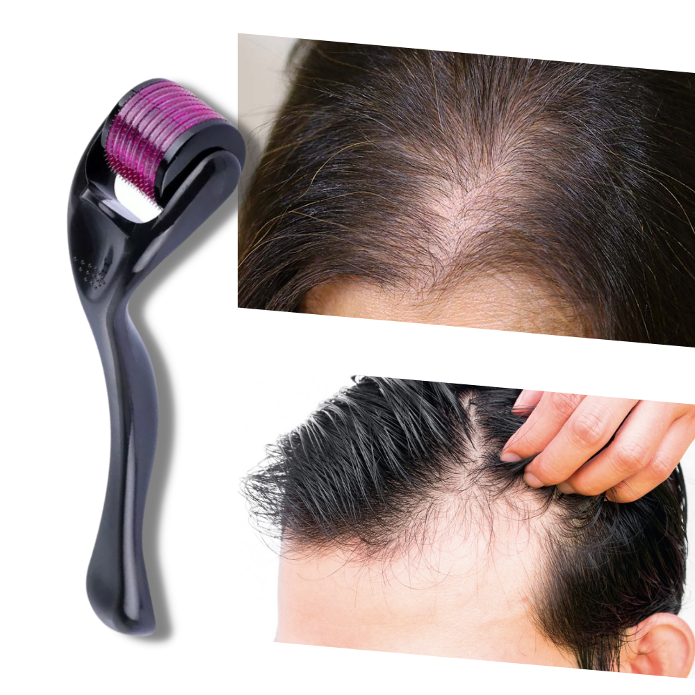 Rouleau dermique pour la croissance des cheveux et de la barbe