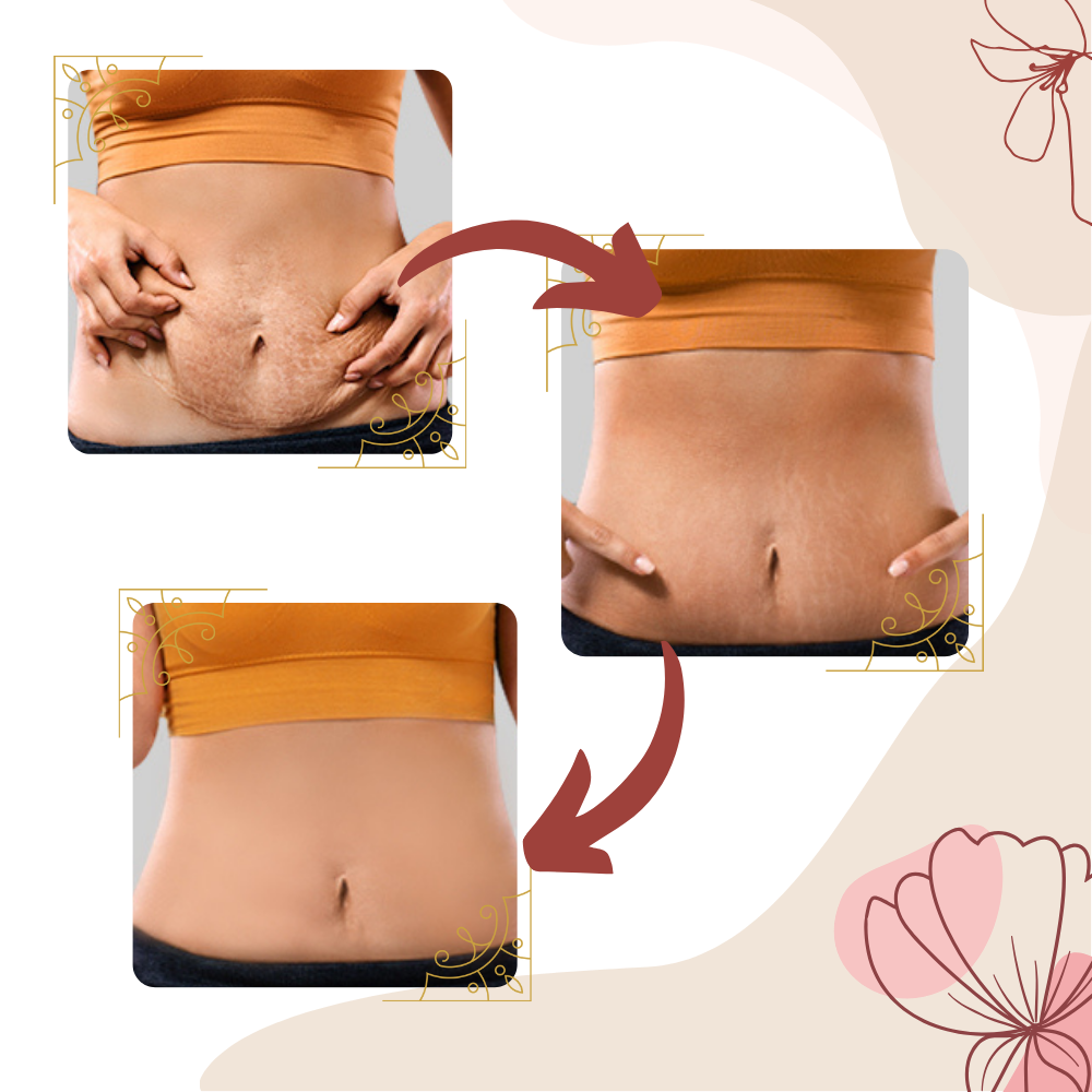 Masseur anti-cellulite par vibrations à haute fréquence