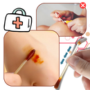 Iodine Swabsticks