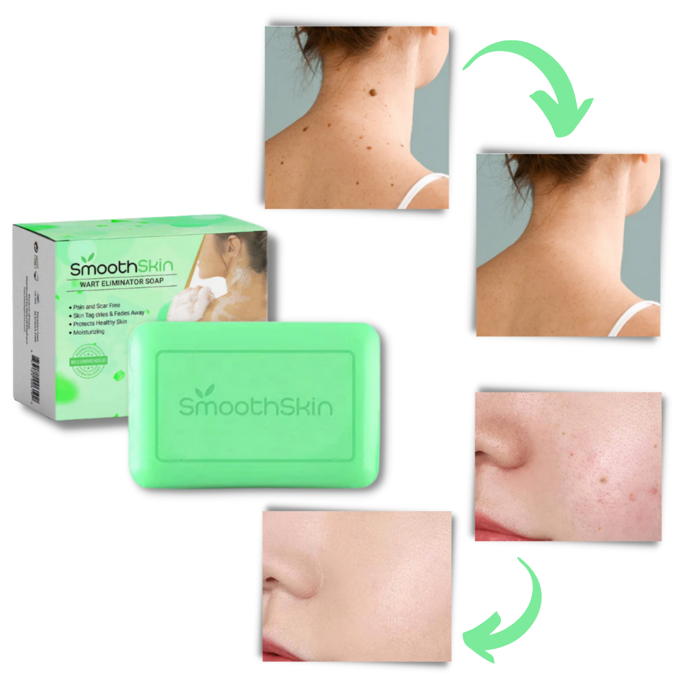 Savon exfoliant hydratant contre les verrues