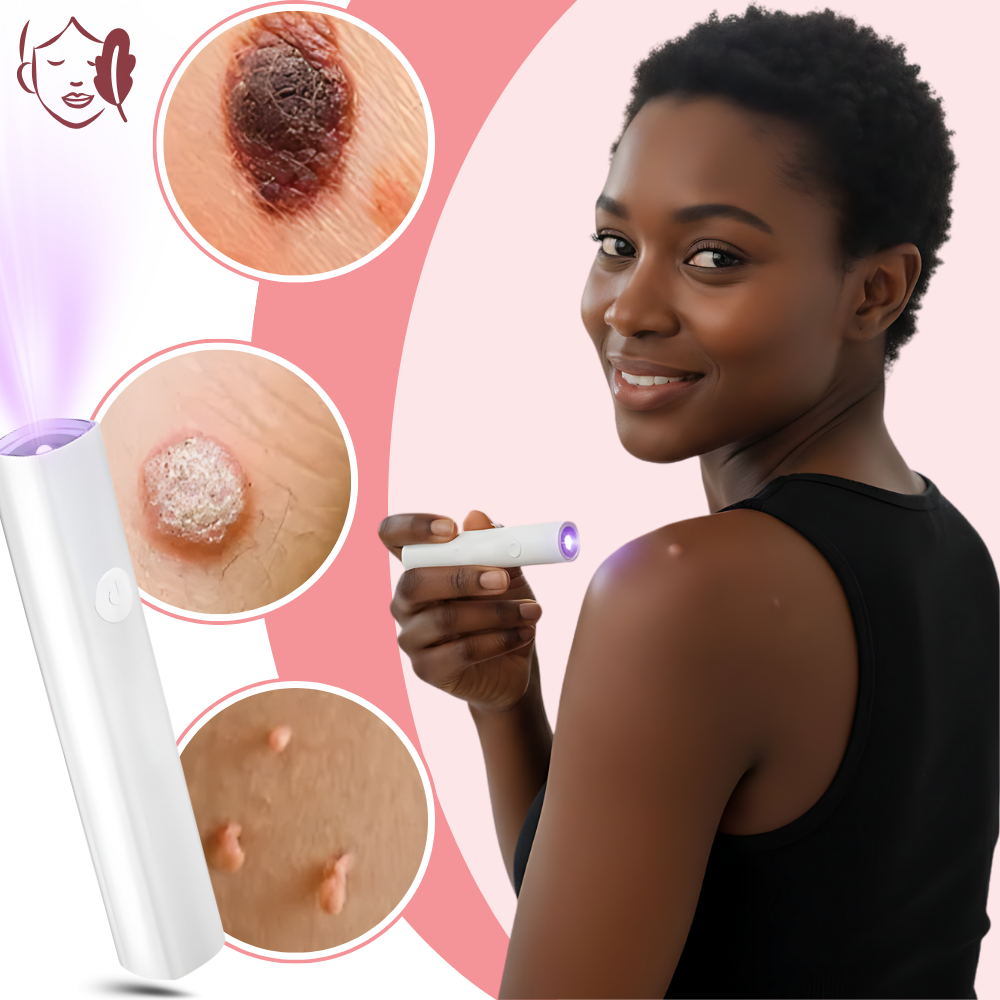 Stylo laser cosmétique Radiance