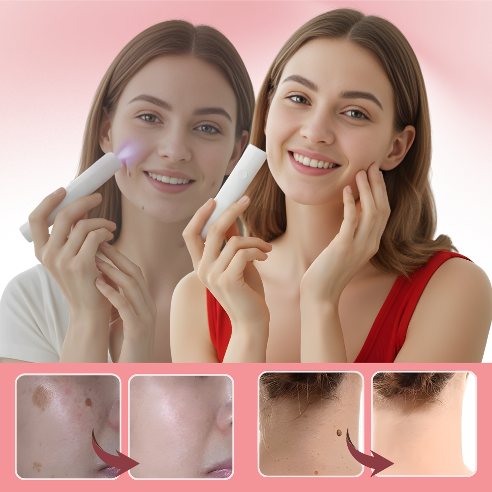 Stylo laser cosmétique Radiance
