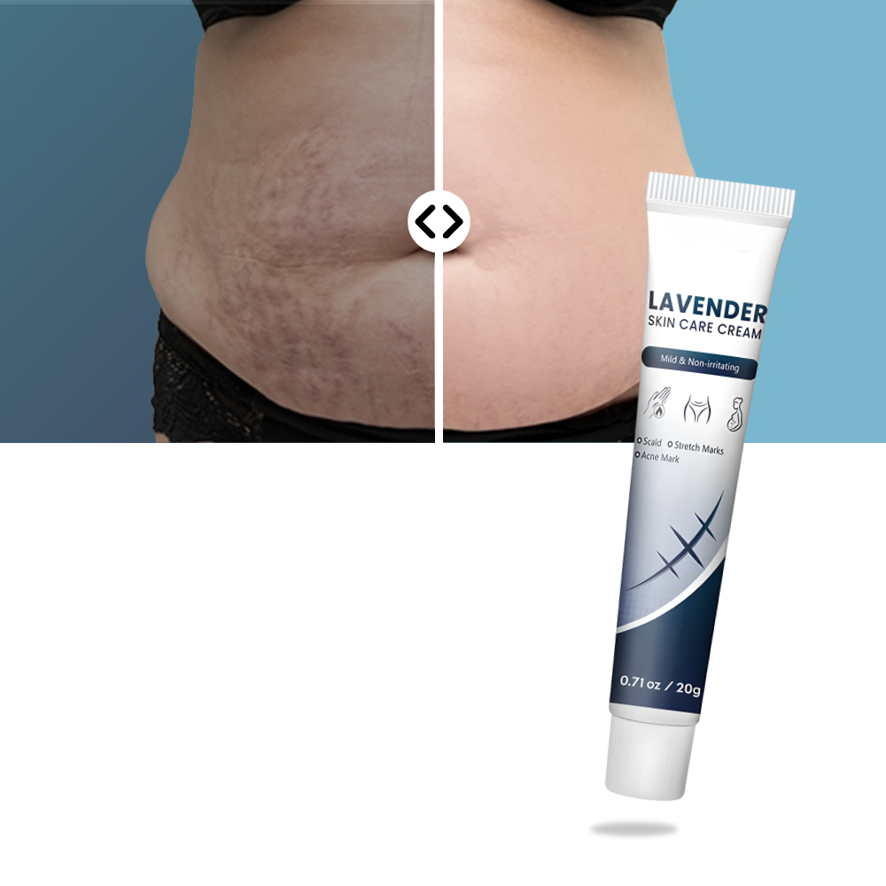 Crème hydratante au silicone pour cicatrices de grossesse