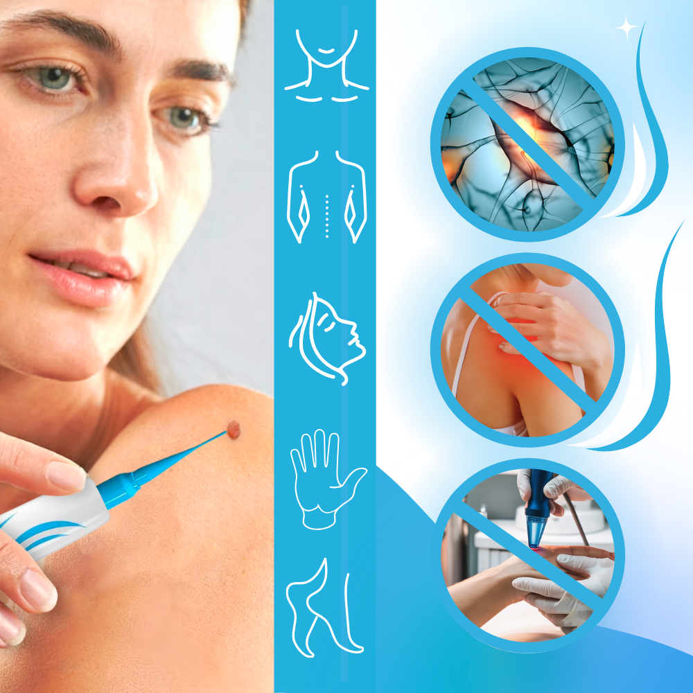 Skin Tag Removal Pro