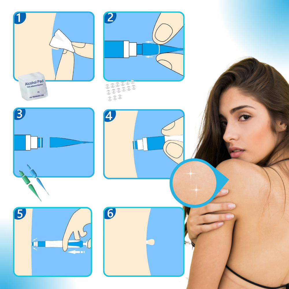 Kit de Traitement Pro des Acrochordons