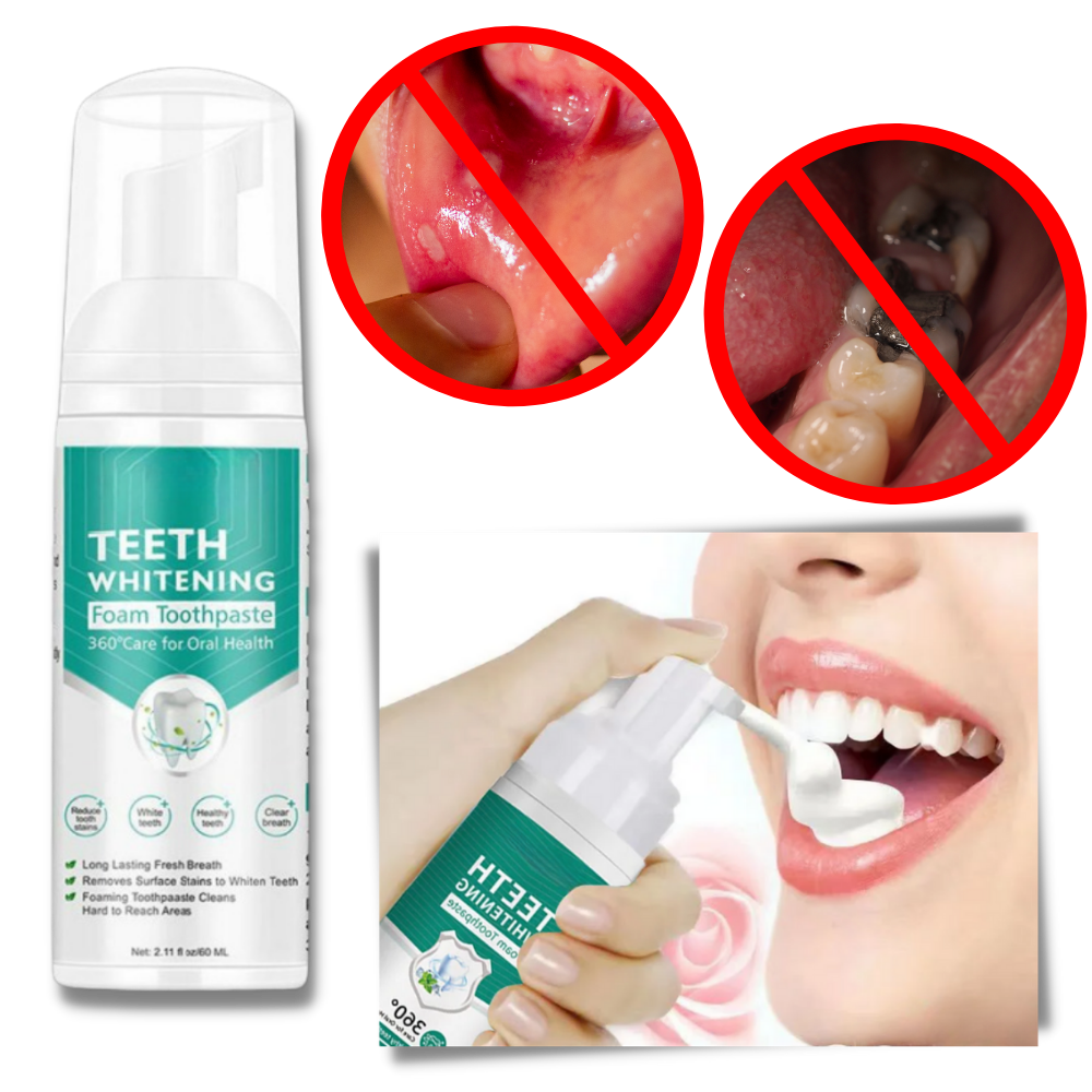 Mousse blanchissante pour les dents